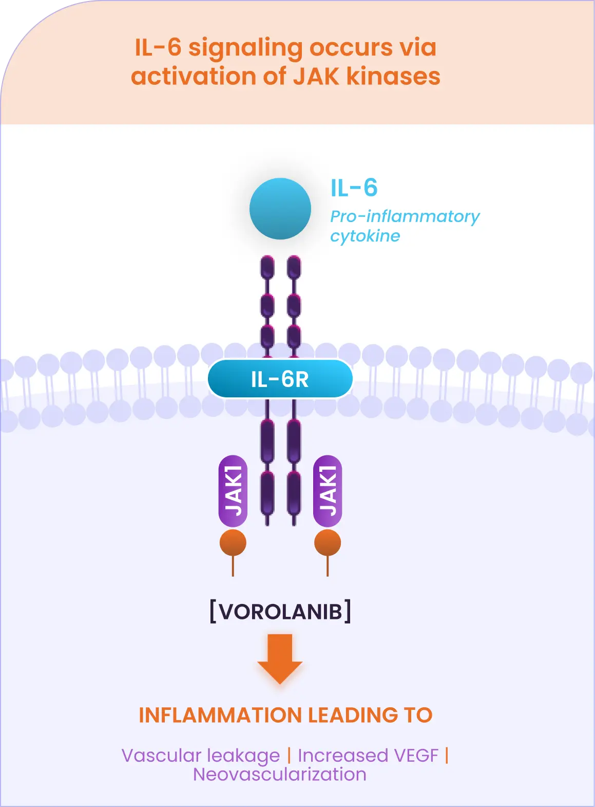 Vorolanib uniquely targets JAK-1, directly suppressing IL-6 pro-inflammatory signaling.